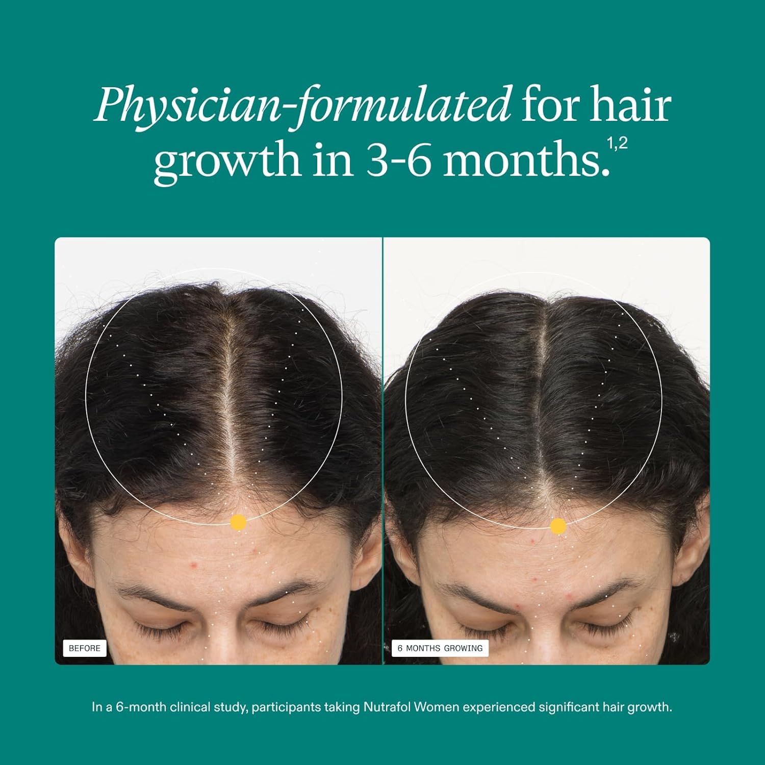 Hair Growth - Nutrafol