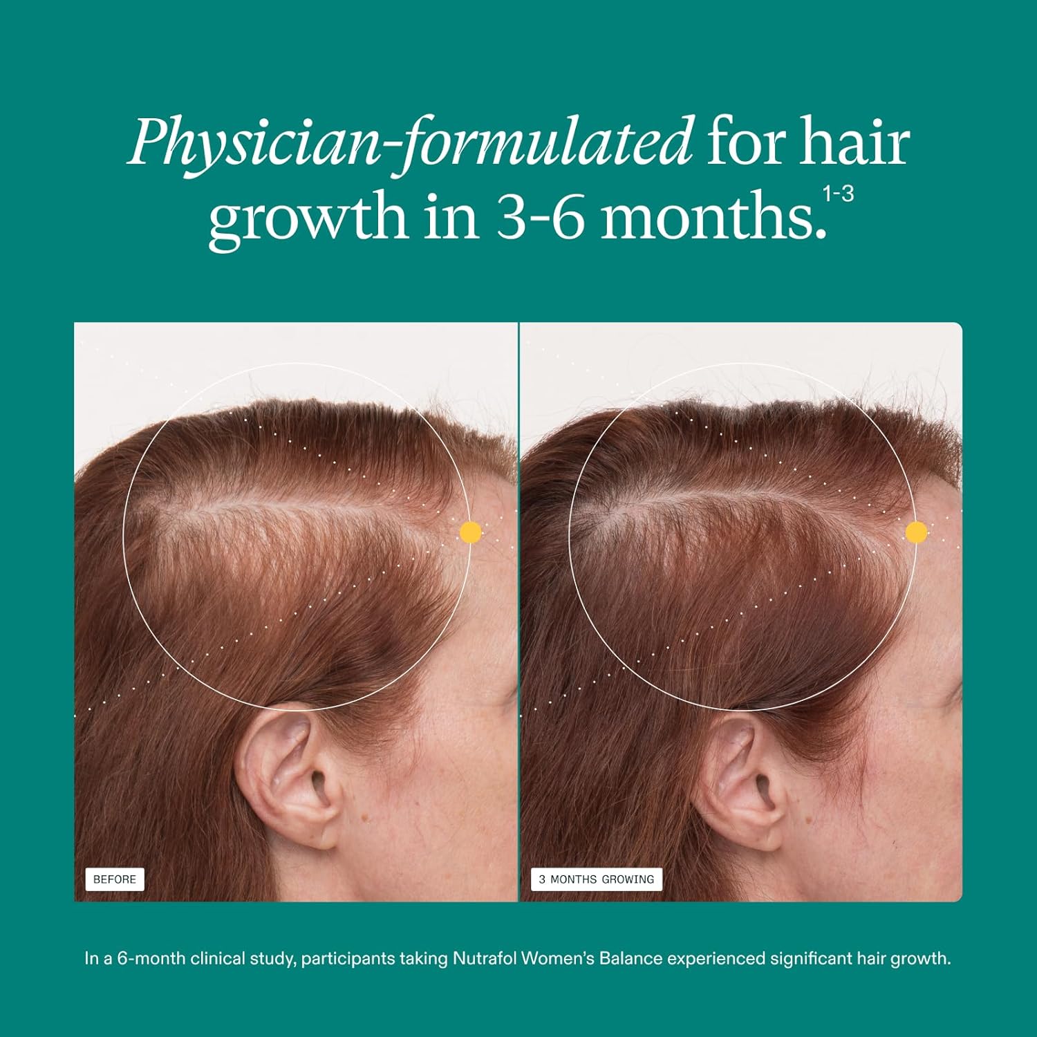 Hair Growth Balance - Nutrafol